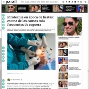 Pirotecnia en epoca de fiestas es una de las causas mas frecuentes de ceguera Bianchi German